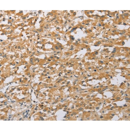 Immunohistochemistry - ARHGEF1 Antibody from Signalway Antibody (36133) - Antibodies.com