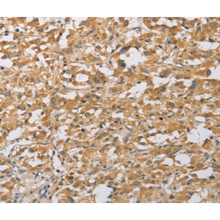 Immunohistochemistry - ARHGEF1 Antibody from Signalway Antibody (36133) - Antibodies.com
