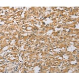 Immunohistochemistry - ARHGEF1 Antibody from Signalway Antibody (36133) - Antibodies.com