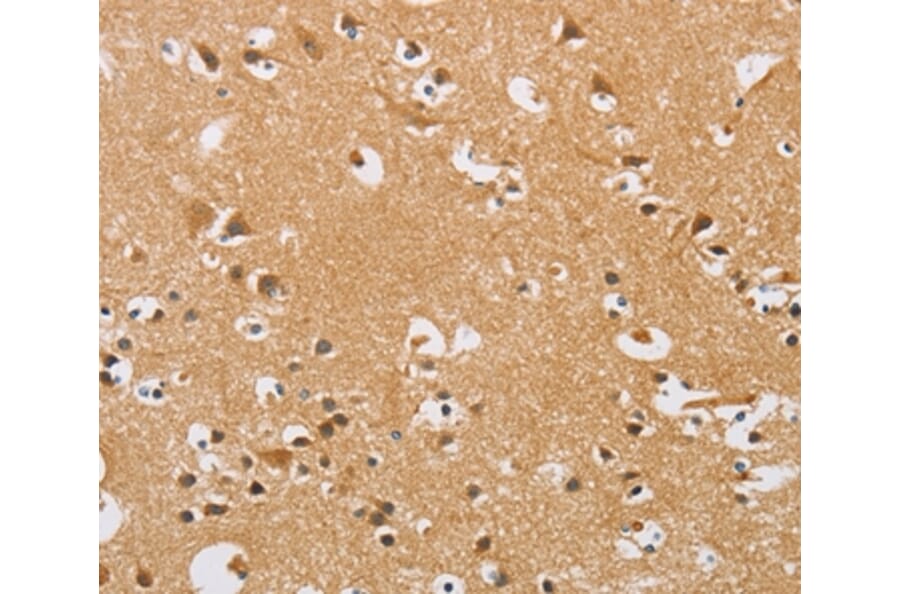 Immunohistochemistry - ARHGEF1 Antibody from Signalway Antibody (36133) - Antibodies.com
