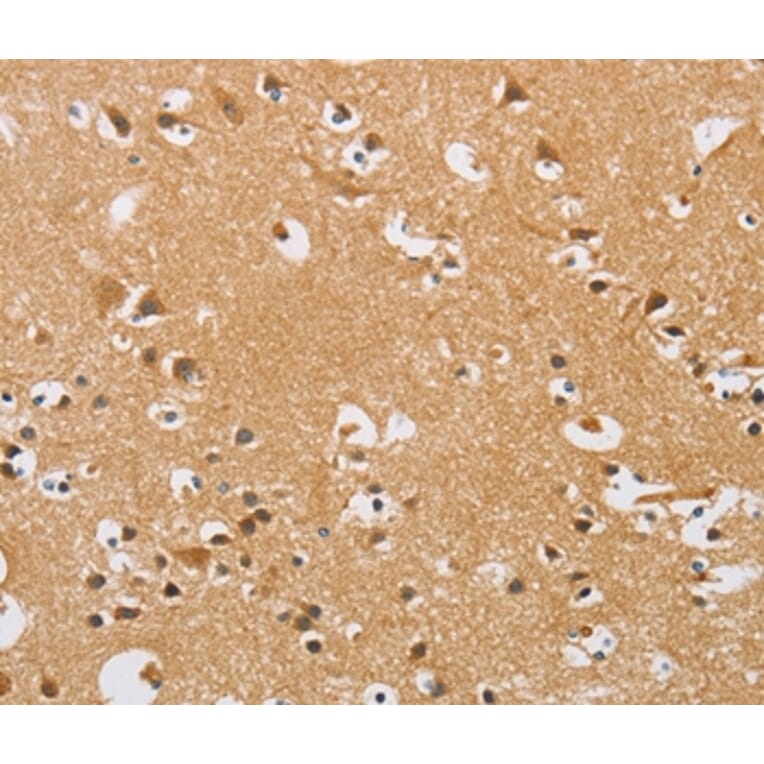 Immunohistochemistry - ARHGEF1 Antibody from Signalway Antibody (36133) - Antibodies.com