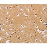 Immunohistochemistry - ARHGEF1 Antibody from Signalway Antibody (36133) - Antibodies.com