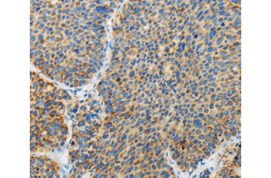 Immunohistochemistry - ARHGEF3 Antibody from Signalway Antibody (36134) - Antibodies.com