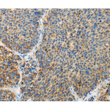 Immunohistochemistry - ARHGEF3 Antibody from Signalway Antibody (36134) - Antibodies.com