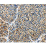 Immunohistochemistry - ARHGEF3 Antibody from Signalway Antibody (36134) - Antibodies.com