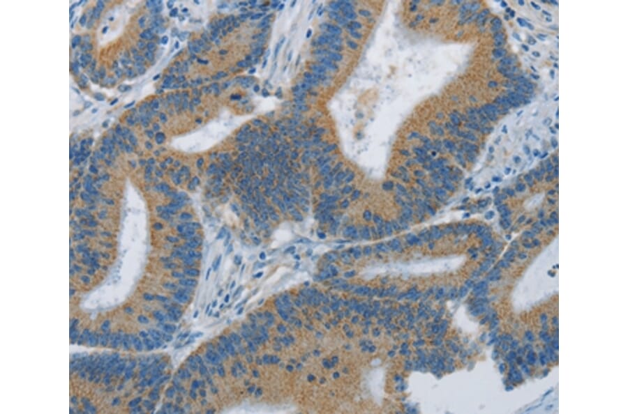 Immunohistochemistry - ARHGEF3 Antibody from Signalway Antibody (36134) - Antibodies.com