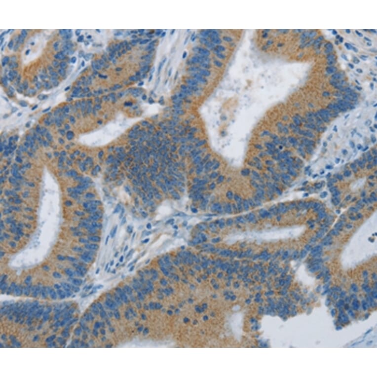 Immunohistochemistry - ARHGEF3 Antibody from Signalway Antibody (36134) - Antibodies.com