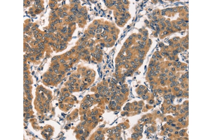 Immunohistochemistry - ARL6IP1 Antibody from Signalway Antibody (36141) - Antibodies.com