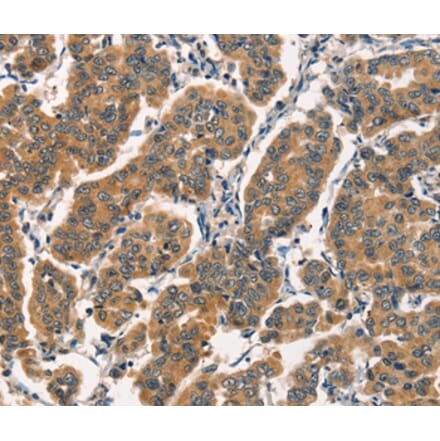 Immunohistochemistry - ARL6IP1 Antibody from Signalway Antibody (36141) - Antibodies.com