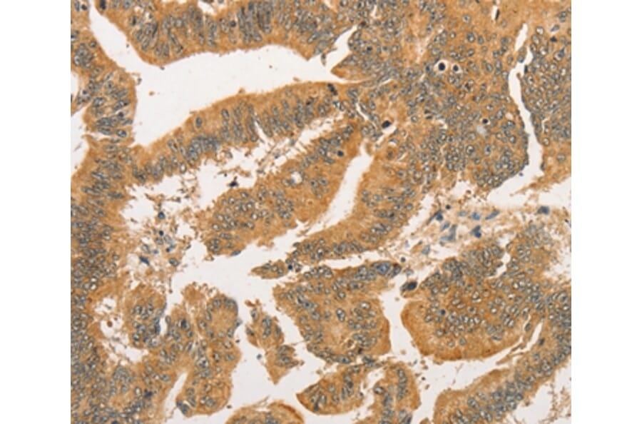 Immunohistochemistry - BCL2L14 Antibody from Signalway Antibody (36161) - Antibodies.com