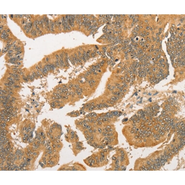 Immunohistochemistry - BCL2L14 Antibody from Signalway Antibody (36161) - Antibodies.com