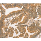 Immunohistochemistry - BCL2L14 Antibody from Signalway Antibody (36161) - Antibodies.com