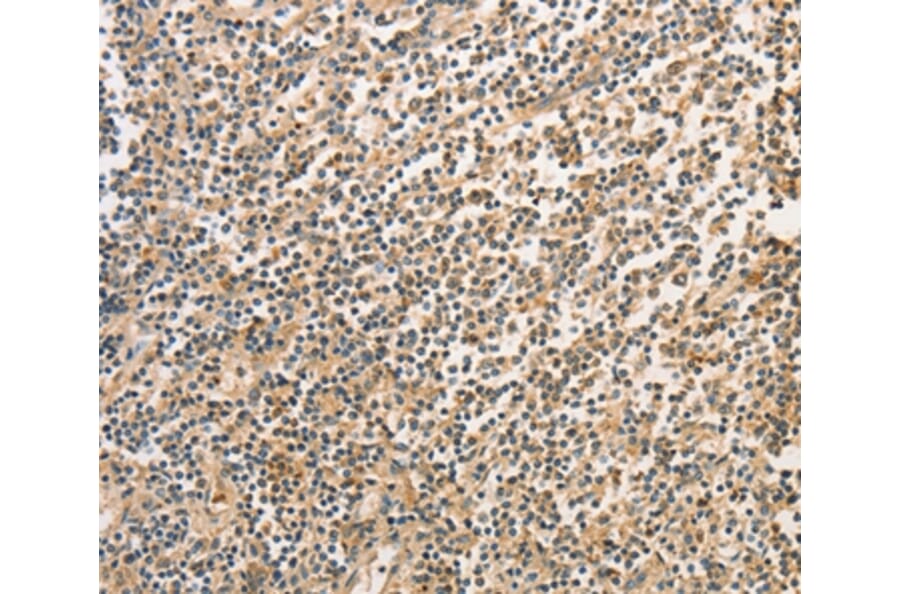 Immunohistochemistry - BCL2L14 Antibody from Signalway Antibody (36161) - Antibodies.com