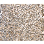 Immunohistochemistry - BCL2L14 Antibody from Signalway Antibody (36161) - Antibodies.com