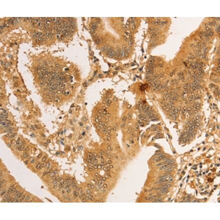 Immunohistochemistry - RPL26L1 Antibody from Signalway Antibody (36167) - Antibodies.com