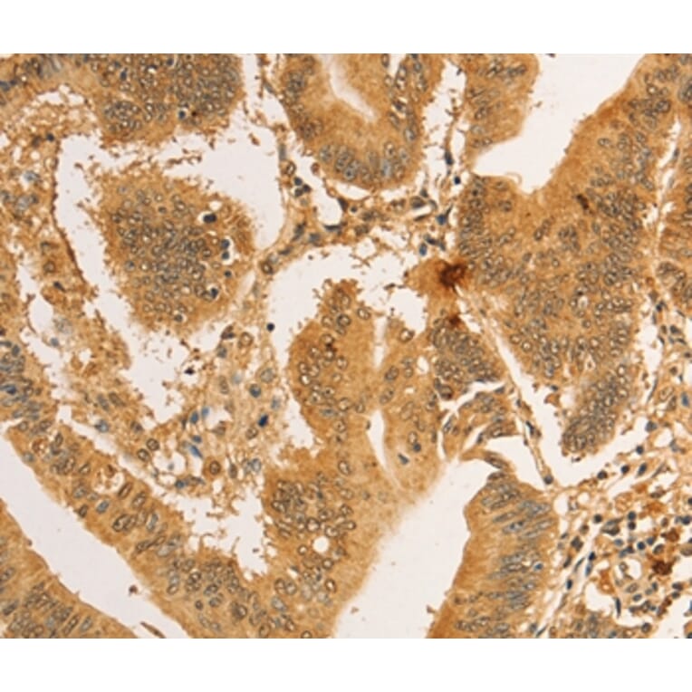 Immunohistochemistry - RPL26L1 Antibody from Signalway Antibody (36167) - Antibodies.com