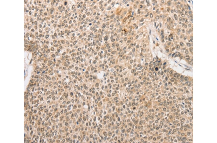 Immunohistochemistry - RPL26L1 Antibody from Signalway Antibody (36167) - Antibodies.com