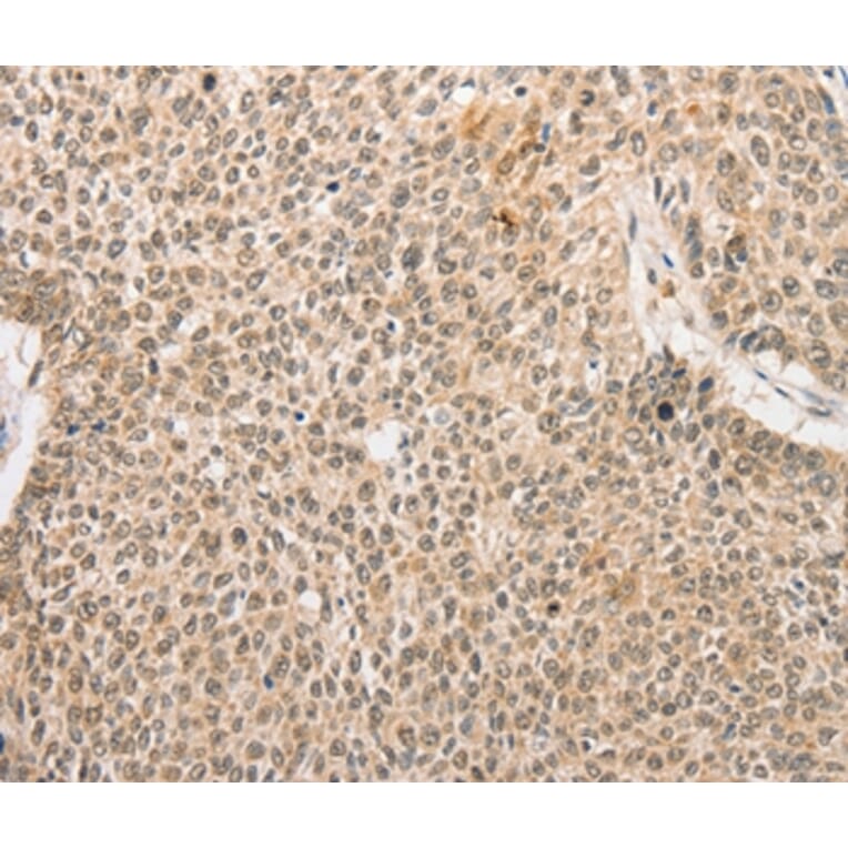 Immunohistochemistry - RPL26L1 Antibody from Signalway Antibody (36167) - Antibodies.com