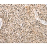 Immunohistochemistry - RPL26L1 Antibody from Signalway Antibody (36167) - Antibodies.com