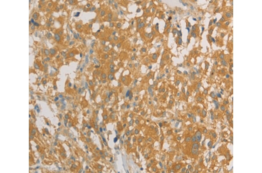 Immunohistochemistry - PRPSAP1 Antibody from Signalway Antibody (36188) - Antibodies.com