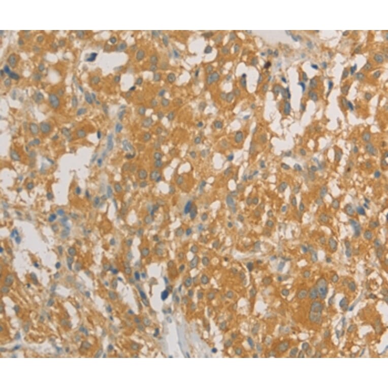 Immunohistochemistry - PRPSAP1 Antibody from Signalway Antibody (36188) - Antibodies.com