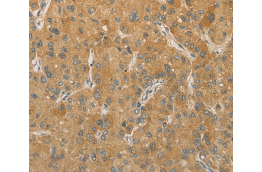Immunohistochemistry - PRPSAP1 Antibody from Signalway Antibody (36188) - Antibodies.com