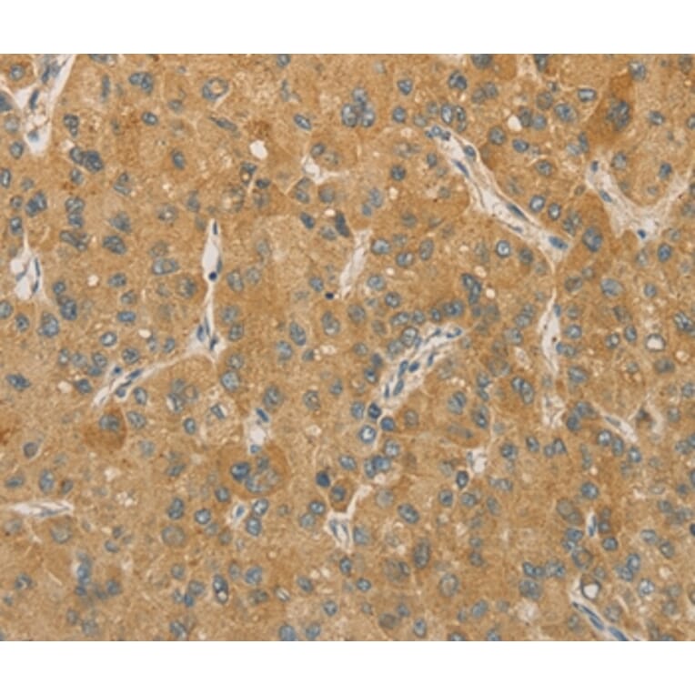 Immunohistochemistry - PRPSAP1 Antibody from Signalway Antibody (36188) - Antibodies.com