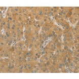 Immunohistochemistry - PRPSAP1 Antibody from Signalway Antibody (36188) - Antibodies.com