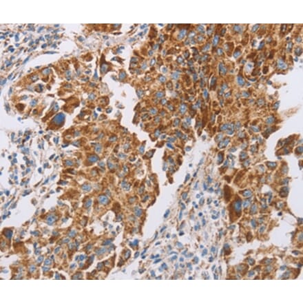 Immunohistochemistry - GUCY1A3 Antibody from Signalway Antibody (36190) - Antibodies.com