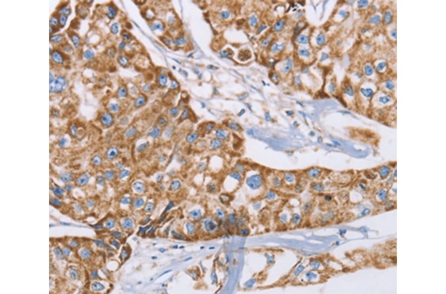 Immunohistochemistry - GUCY1A3 Antibody from Signalway Antibody (36190) - Antibodies.com