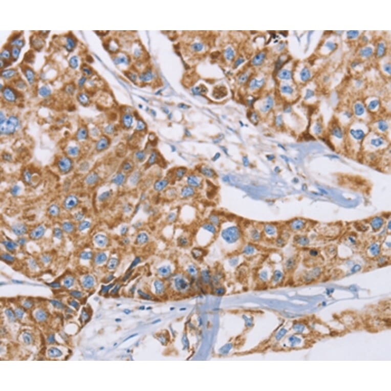 Immunohistochemistry - GUCY1A3 Antibody from Signalway Antibody (36190) - Antibodies.com