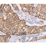 Immunohistochemistry - GUCY1A3 Antibody from Signalway Antibody (36190) - Antibodies.com