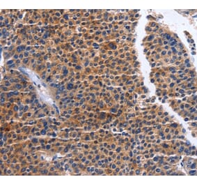 Immunohistochemistry - MAP3K13 Antibody from Signalway Antibody (36205) - Antibodies.com