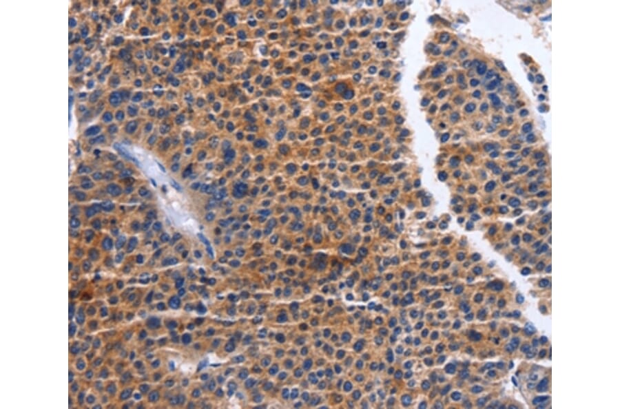 Immunohistochemistry - MAP3K13 Antibody from Signalway Antibody (36205) - Antibodies.com