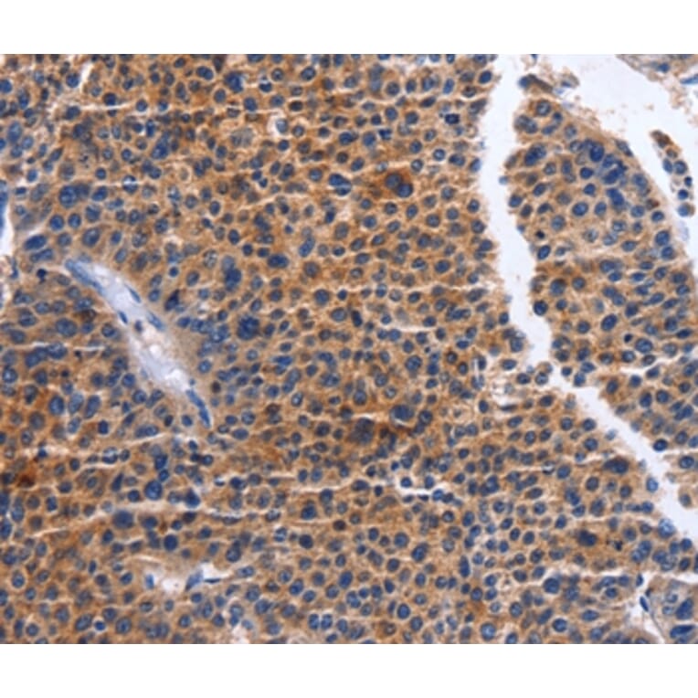 Immunohistochemistry - MAP3K13 Antibody from Signalway Antibody (36205) - Antibodies.com
