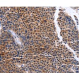Immunohistochemistry - MAP3K13 Antibody from Signalway Antibody (36205) - Antibodies.com
