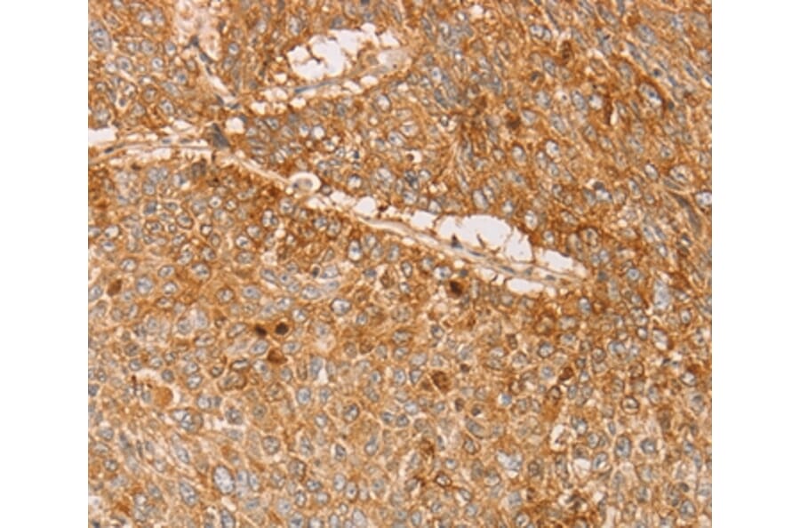 Immunohistochemistry - PACSIN2 Antibody from Signalway Antibody (36208) - Antibodies.com