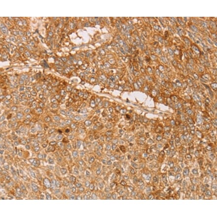 Immunohistochemistry - PACSIN2 Antibody from Signalway Antibody (36208) - Antibodies.com