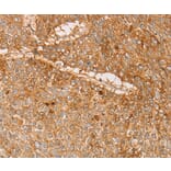 Immunohistochemistry - PACSIN2 Antibody from Signalway Antibody (36208) - Antibodies.com