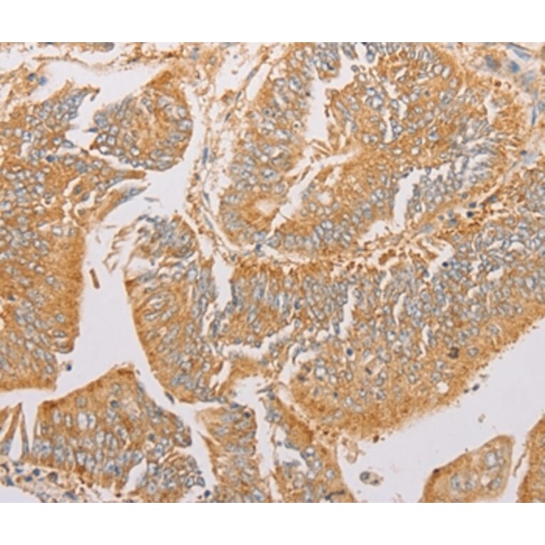 Immunohistochemistry - PACSIN2 Antibody from Signalway Antibody (36208) - Antibodies.com