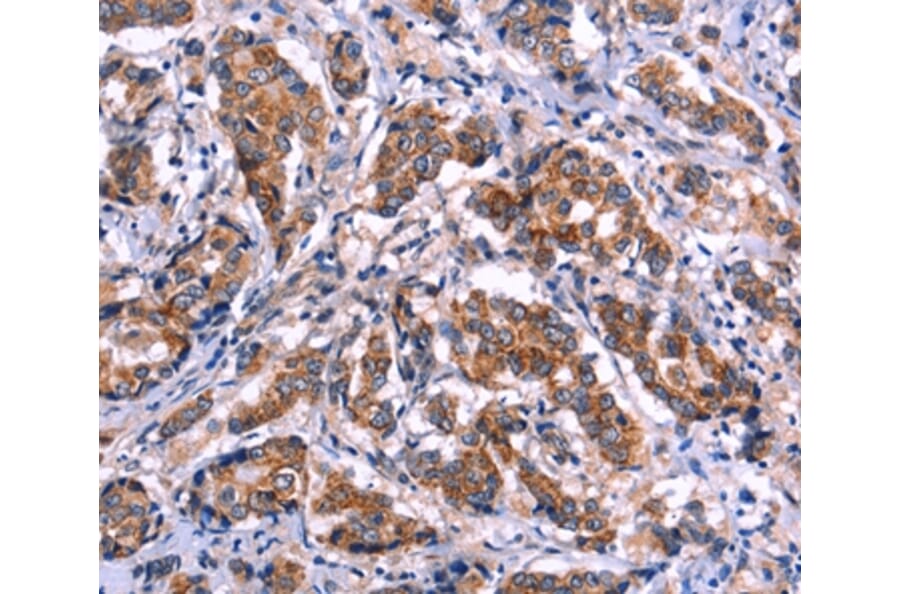 Immunohistochemistry - EIF2AK4 Antibody from Signalway Antibody (36231) - Antibodies.com