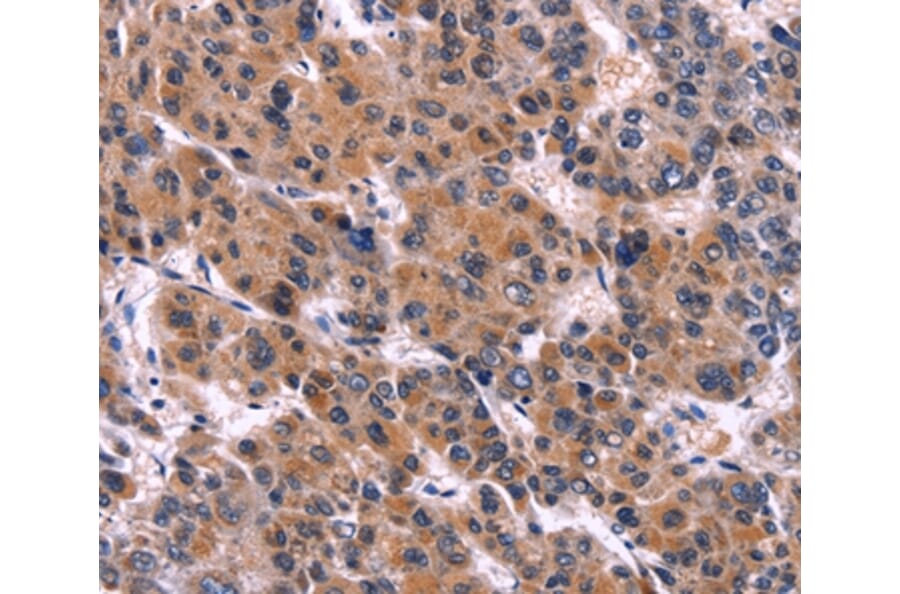 Immunohistochemistry - EIF2AK4 Antibody from Signalway Antibody (36231) - Antibodies.com