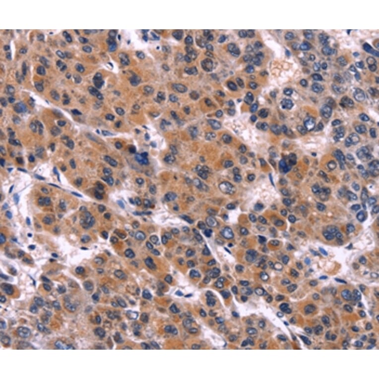 Immunohistochemistry - EIF2AK4 Antibody from Signalway Antibody (36231) - Antibodies.com