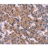 Immunohistochemistry - EIF2AK4 Antibody from Signalway Antibody (36231) - Antibodies.com