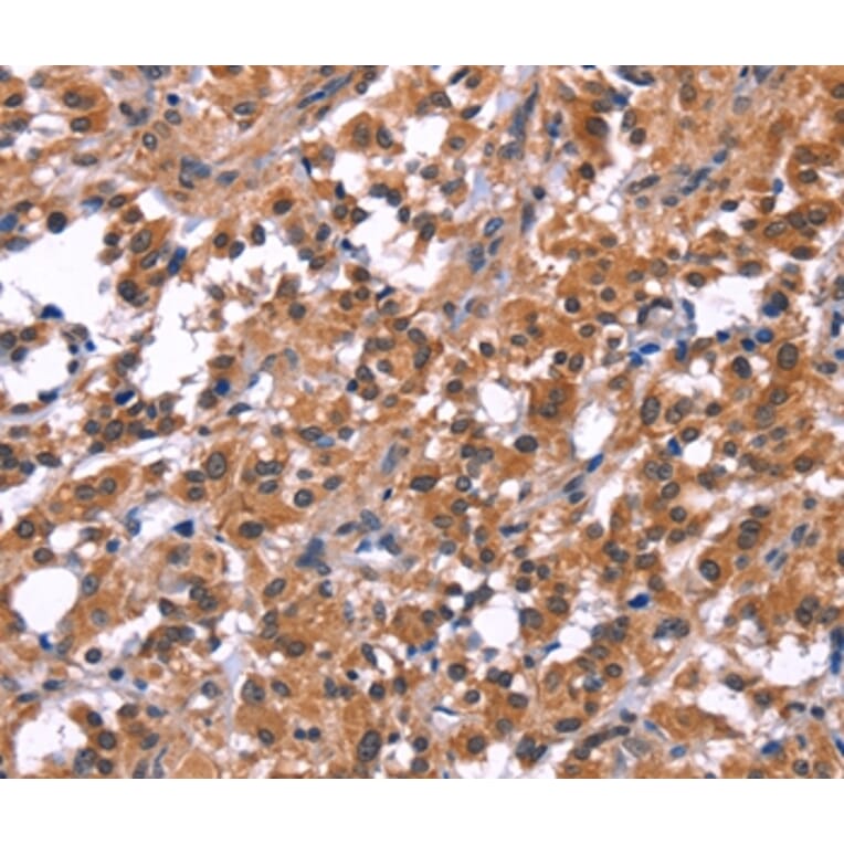 Immunohistochemistry - PIP5K1B Antibody from Signalway Antibody (36234) - Antibodies.com