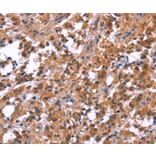 Immunohistochemistry - PIP5K1B Antibody from Signalway Antibody (36234) - Antibodies.com
