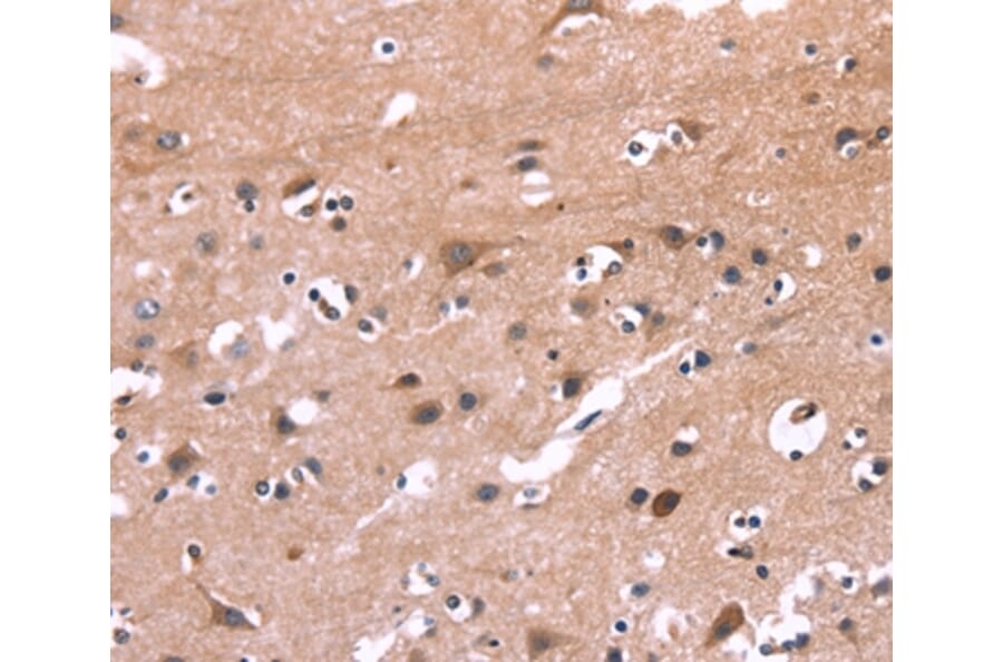 Immunohistochemistry - PIP5K1B Antibody from Signalway Antibody (36234) - Antibodies.com