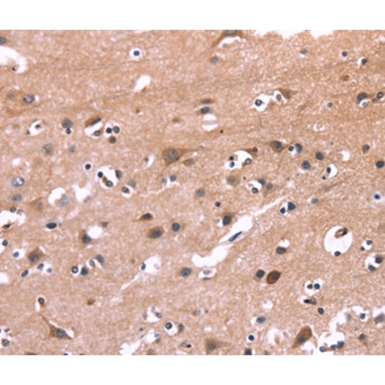 Immunohistochemistry - PIP5K1B Antibody from Signalway Antibody (36234) - Antibodies.com