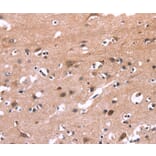 Immunohistochemistry - PIP5K1B Antibody from Signalway Antibody (36234) - Antibodies.com
