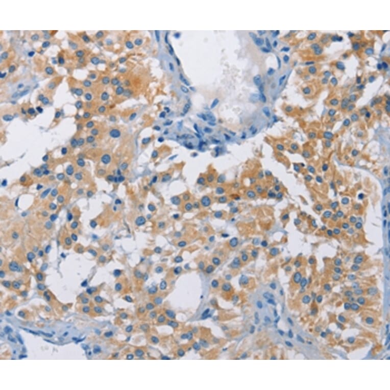 Immunohistochemistry - ATP6AP2 Antibody from Signalway Antibody (36270) - Antibodies.com